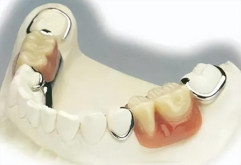萎缩牙龈怎么治疗_牙龈萎缩怎么办教你一招自愈_萎缩的牙龈可以恢复吗